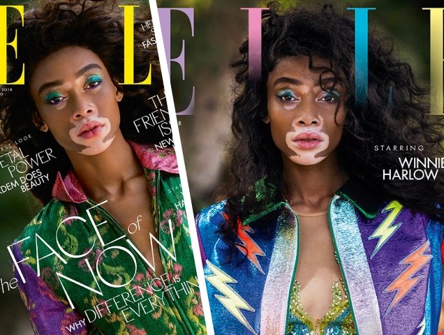 UK Elle May 2018 : Winnie Harlow by Gilles Bensimon